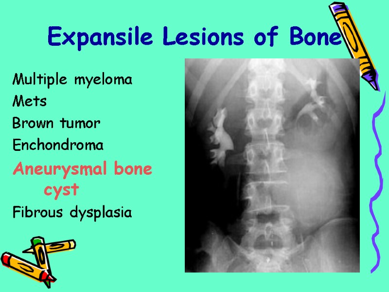 Multiple myeloma  Mets Brown tumor Enchondroma Aneurysmal bone cyst Fibrous dysplasia  Expansile